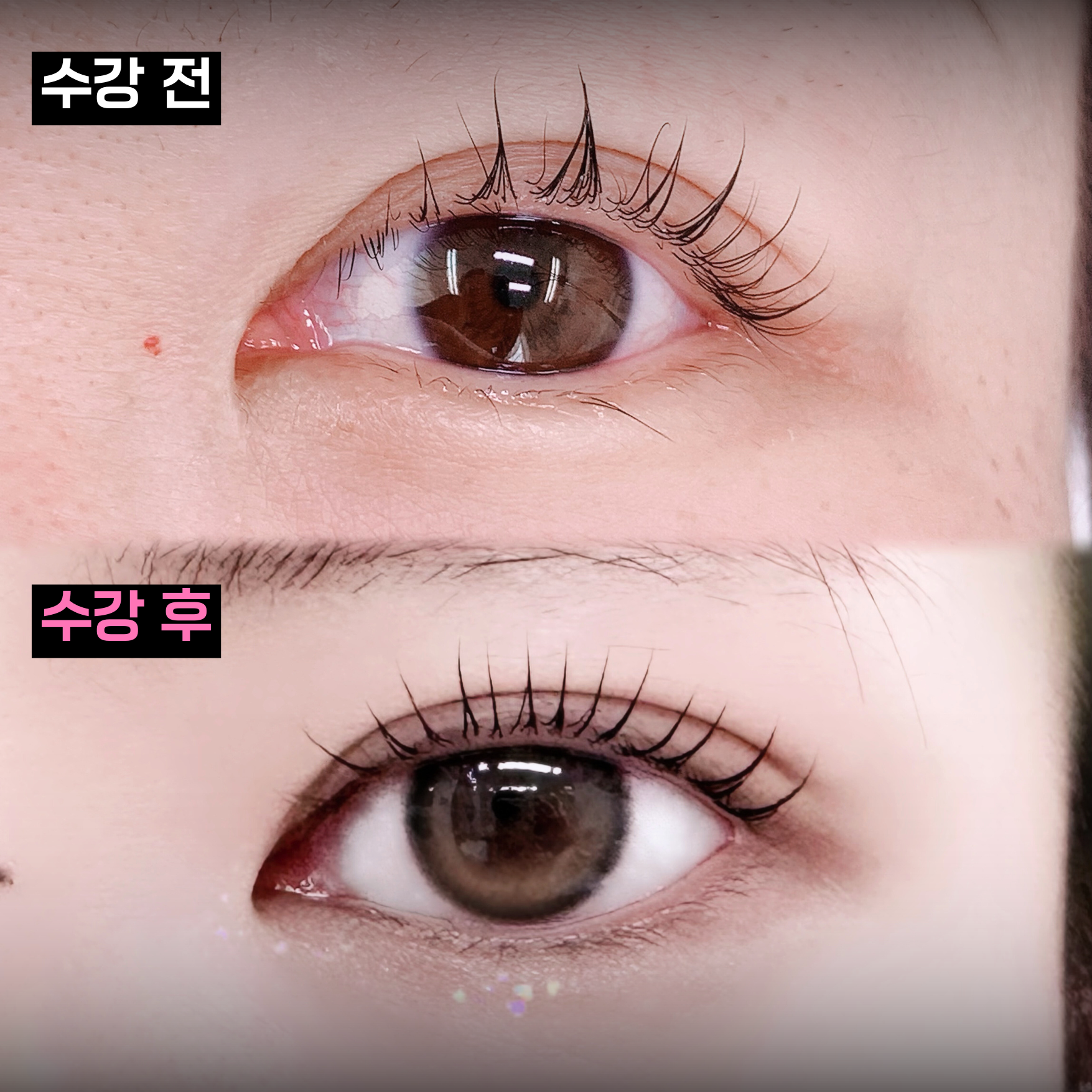 수강생 Before & After 3